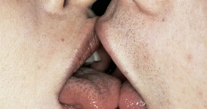 algo que
