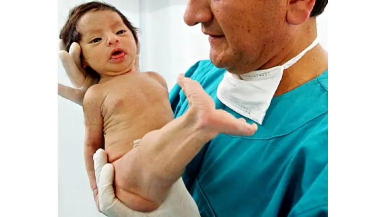 humanos
