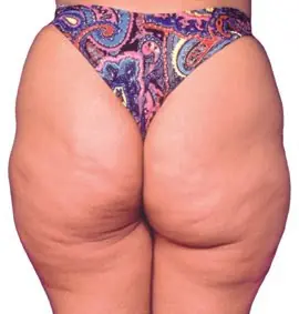 Diferentes tipos de cola