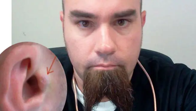 'Biohackers' que experimentan con su cuerpo para mejorarlo
