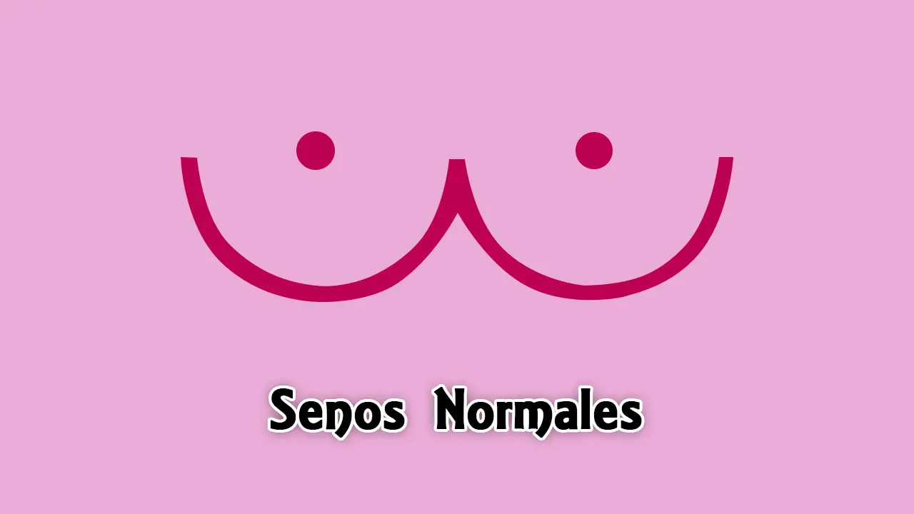 10 señales de alerta de cáncer de mama.