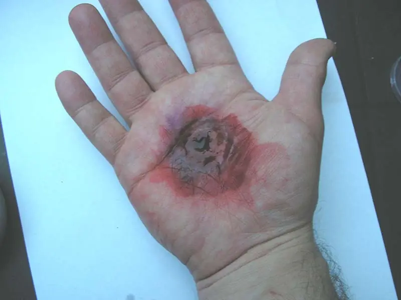 Estigmas