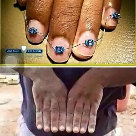 humor para desvelados