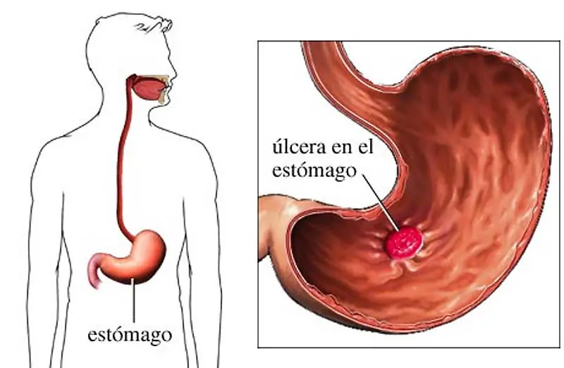 Platano