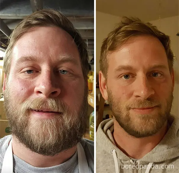 El antes y después de personas que dejaron el alcohol