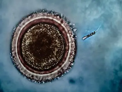 ¡Adelante, espermatozoides motorizados!