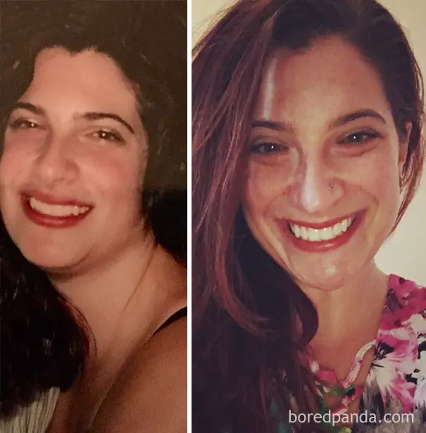 Antes y después de personas que dejaron el alcohol (parte 2)