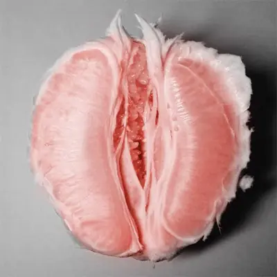 imagenes