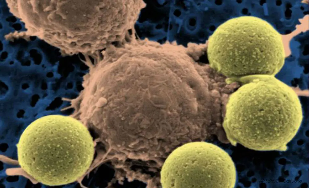 “bacterias magnéticas” una alternativa a la Quimioterapia