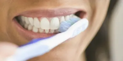 Cómo blanquear los dientes muy fácil