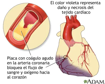 pecho