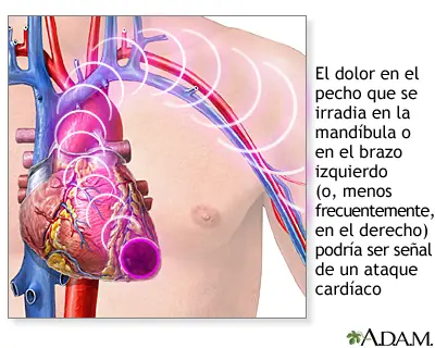 dolor