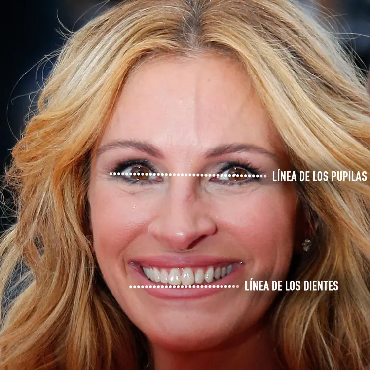 sonrisa