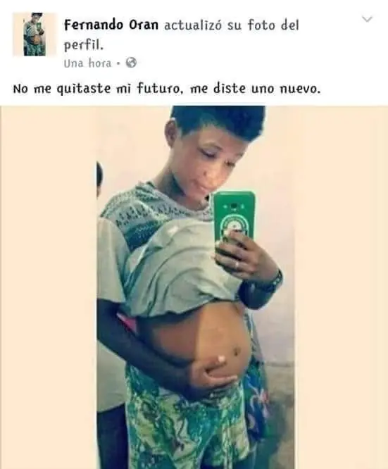 aqui habia una imagen