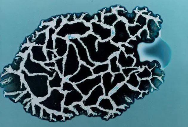 ¿Cómo se ven ciertas drogas bajo el microscopio?