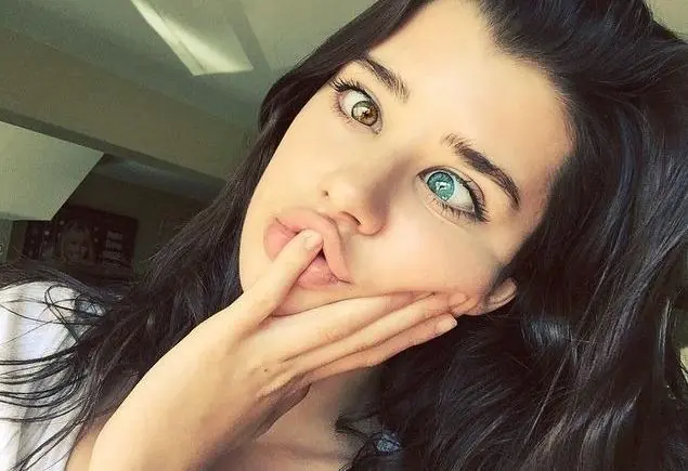 heterocromia