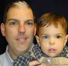 heterocromia