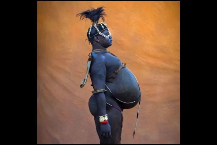 Etiopia