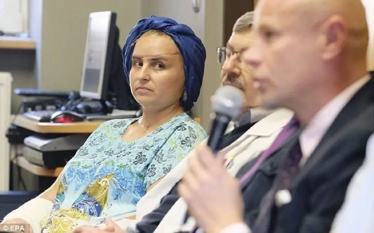 Un tumor facial le desfiguró el rostro, hoy luce increíble