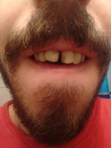 Mi dueño me rompio con una cerveza