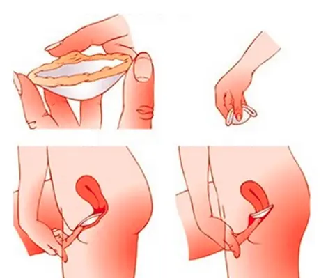 mujeres