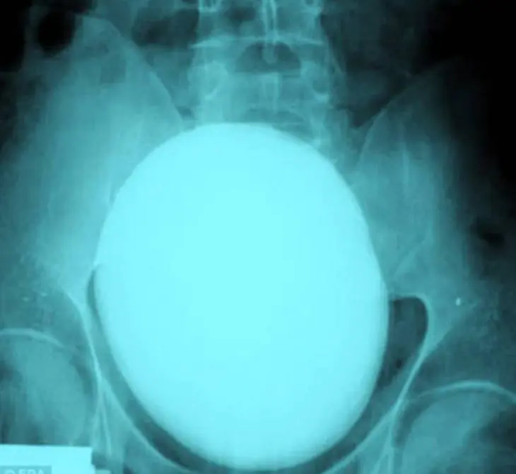 WTF! 16 Radiografías que atormentaron a los médicos