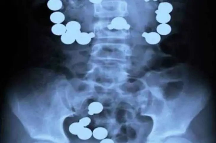 radiografias
