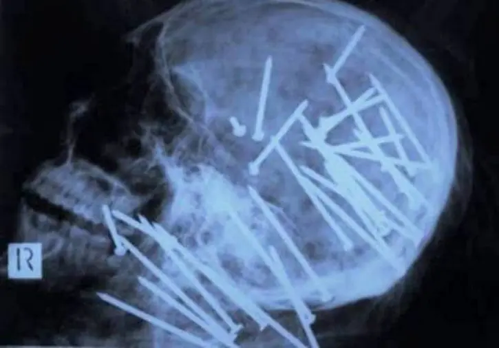 radiografias