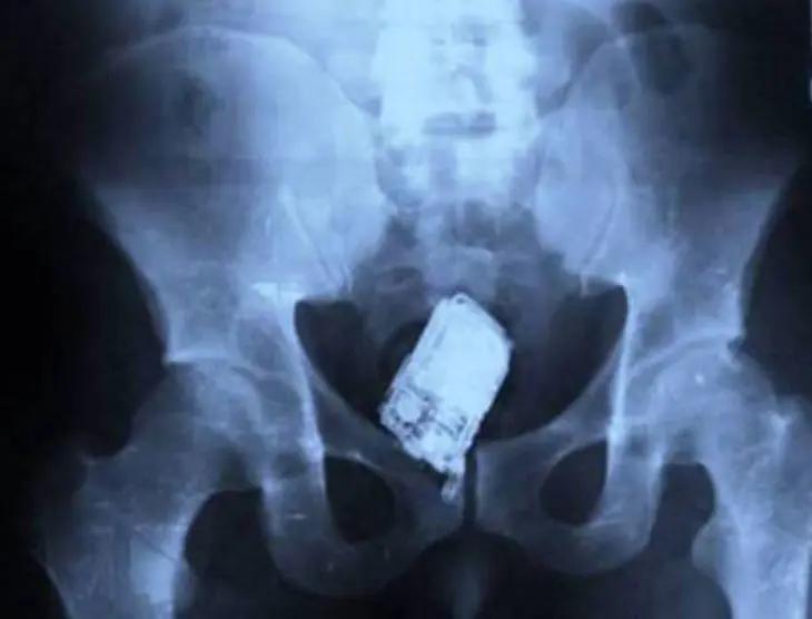 radiografias