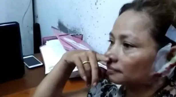médico le arrancó una oreja a su ex mujer por celos en Perú
