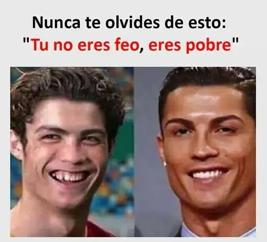 imagenes
