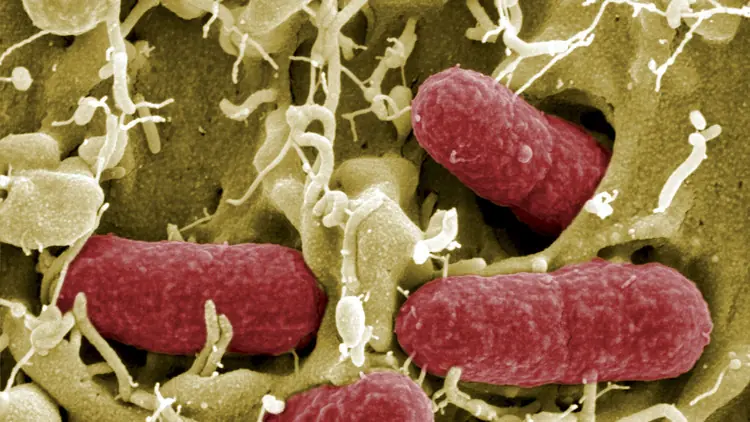 Descubren un 'supermicrobio' resistente a antibióticos