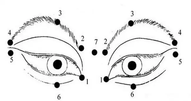 vision vision