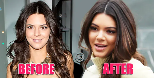 Kendall Kendall