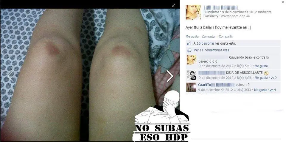 redes