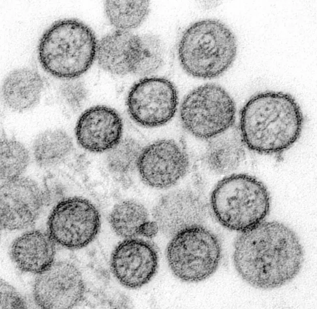 Dengue