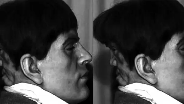 Edward Mordake el hombre con 2 cabezas