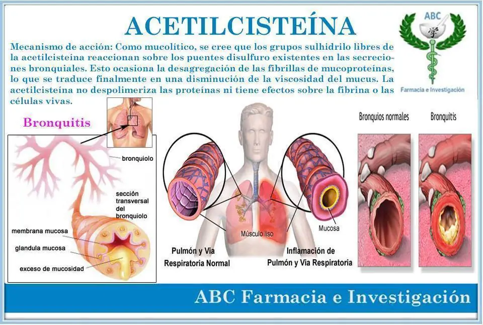 ibuprofeno