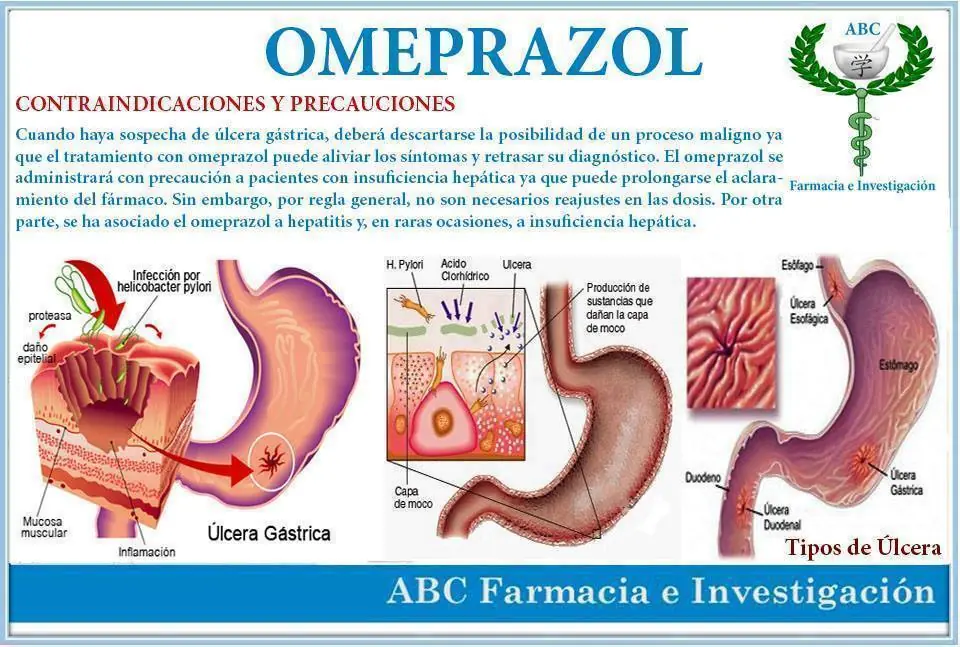 paracetamol