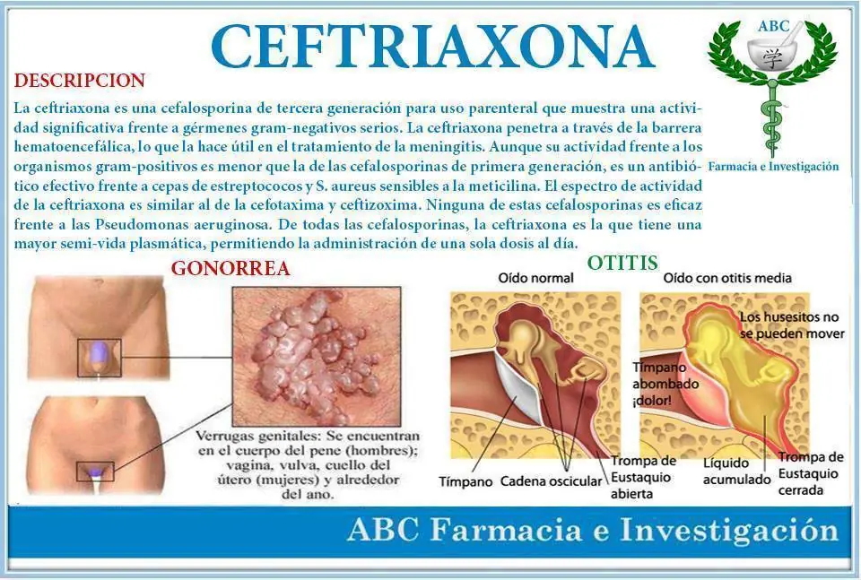 precauciones