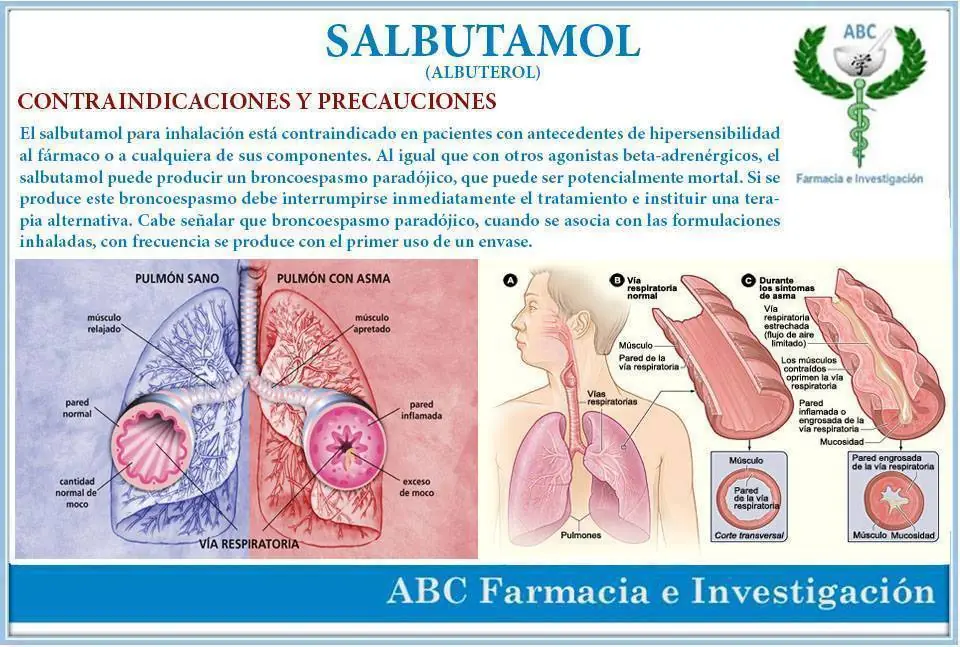 alergia