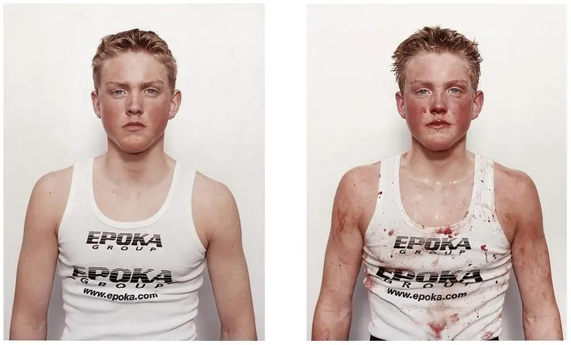 Antes y después del primer combate de boxeo