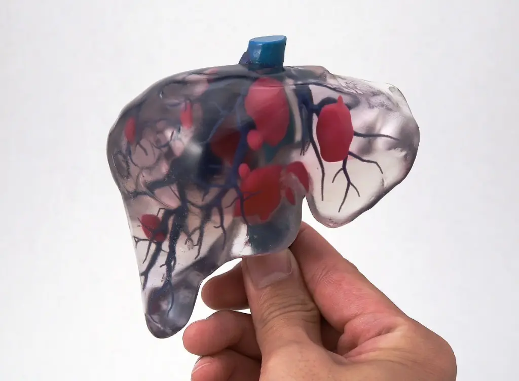 Las 8 aplicaciones médicas de la impresión 3D