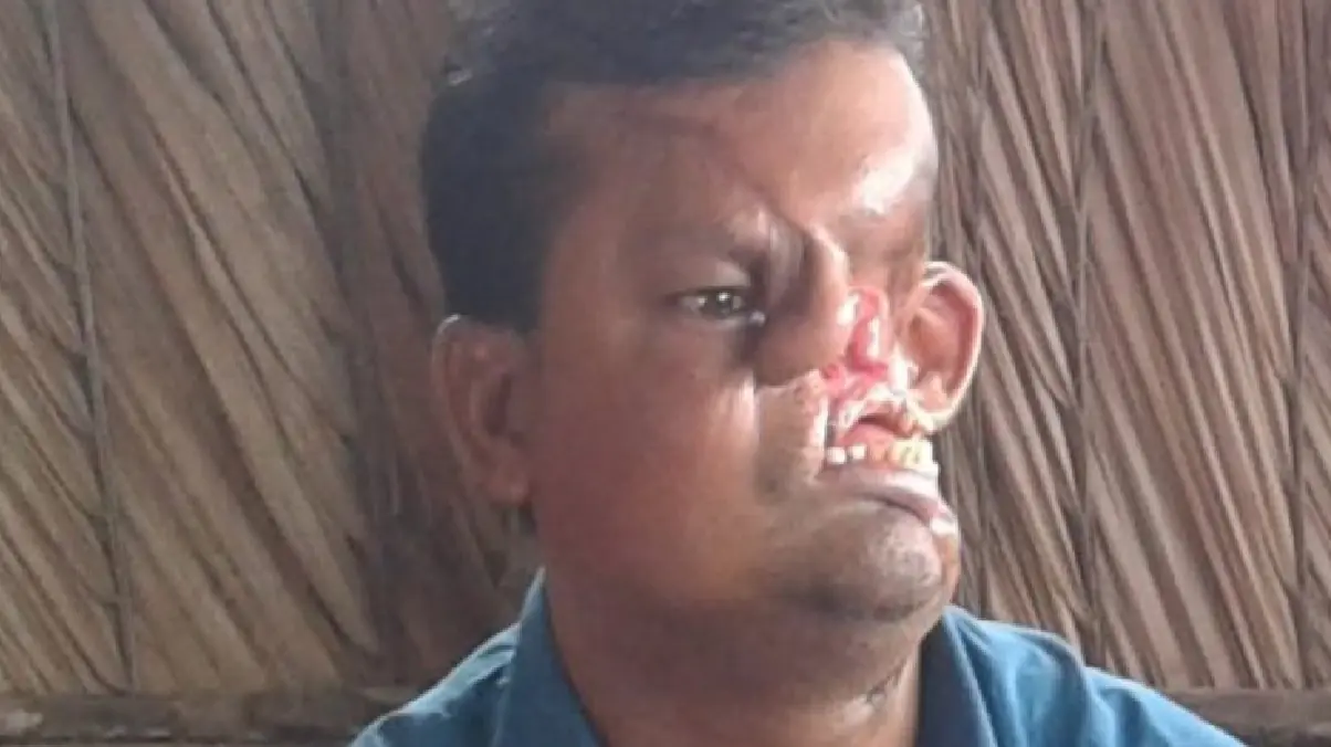 Revela su rostro después de ser atacado por un león