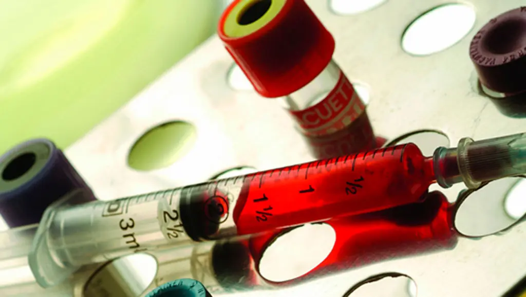 Convocan donantes para incrementar las reservas de sangre