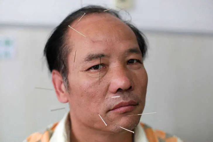 13 extraños síndromes que no creerás que existen