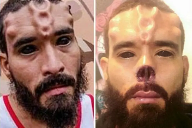 Venezolano gasto 37 mil dolares para parecerse a "Red Skull"
