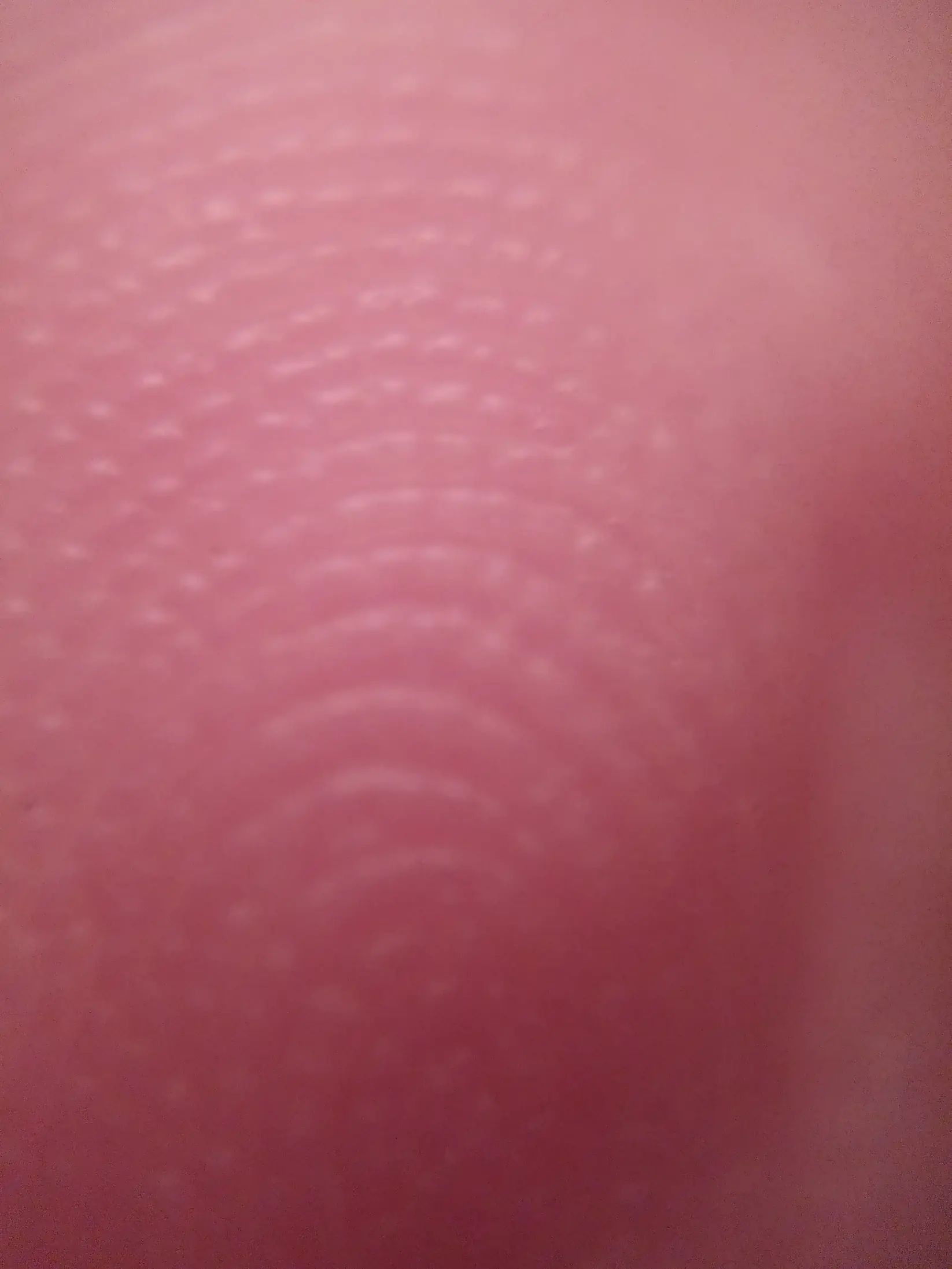 macro