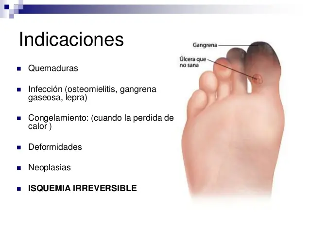 horribles