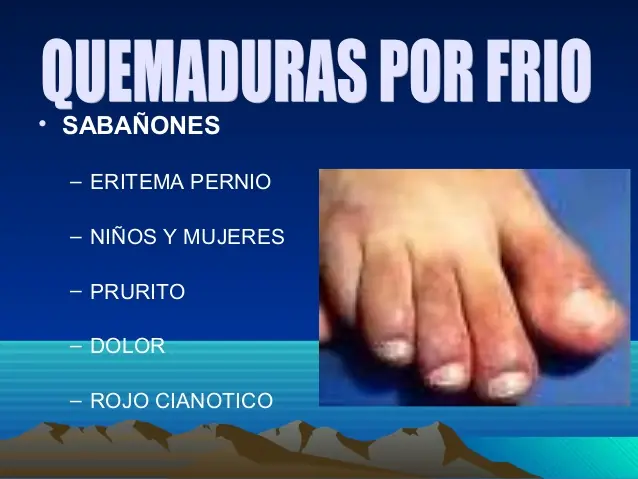 PREFIERO EL CALOR
